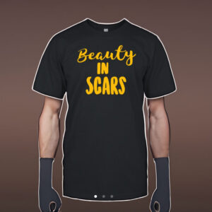 Beauty In Scars Shirt