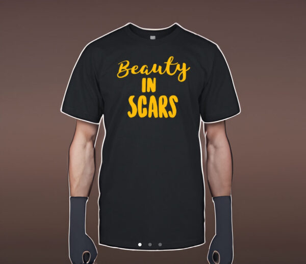 Beauty In Scars Shirt